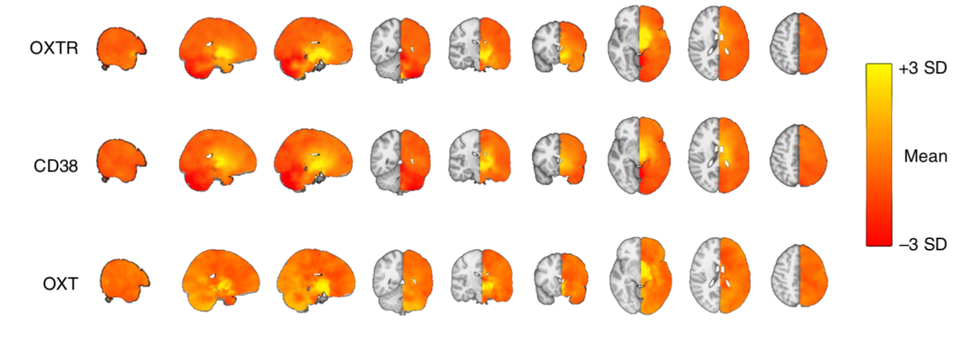 Identifying central targets for intranasal oxytocin administration and the optimal dose